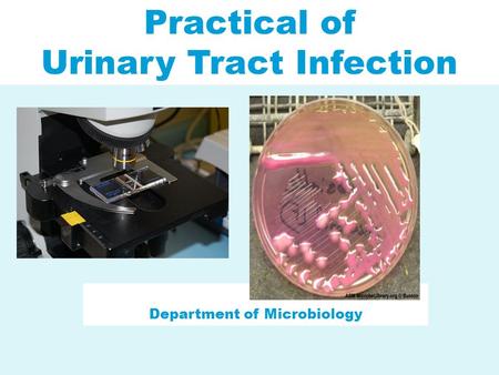 Urinary Tract Infection Department of Microbiology
