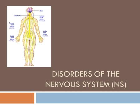 DISORDERS OF THE NERVOUS SYSTEM (NS). Multiple Sclerosis  Affects nerve cells of brain and spinal cord  It is believed to be an autoimmune disorder,