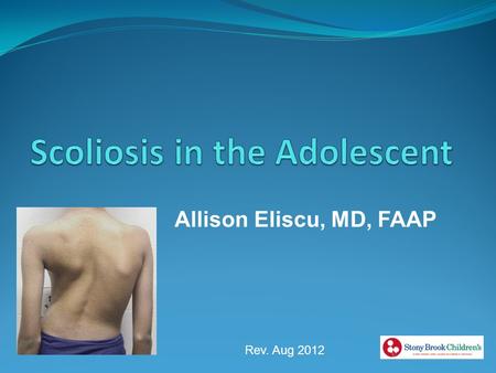 Scoliosis in the Adolescent