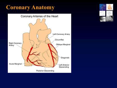 Coronary Anatomy.