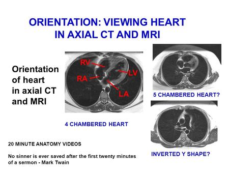ORIENTATION: VIEWING HEART IN AXIAL CT AND MRI Orientation of heart in axial CT and MRI 20 MINUTE ANATOMY VIDEOS No sinner is ever saved after the first.