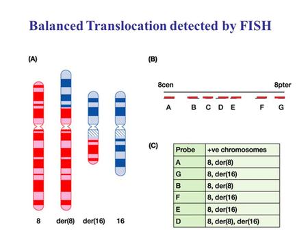 1 Balanced Translocation detected by FISH. 2 Red- Chrom. 5 probe Green- Chrom. 8 probe.
