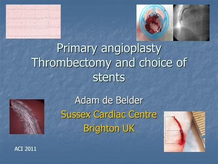 Primary angioplasty Thrombectomy and choice of stents Adam de Belder Sussex Cardiac Centre Brighton UK ACI 2011.