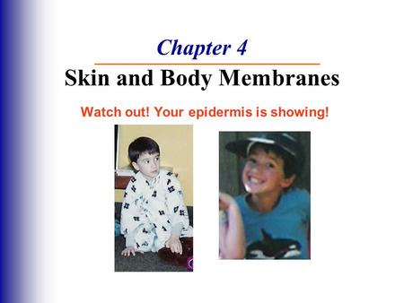 Chapter 4 Skin and Body Membranes Watch out! Your epidermis is showing!