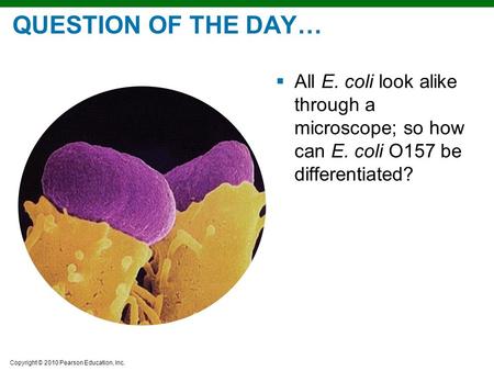QUESTION OF THE DAY… All E. coli look alike through a microscope; so how can E. coli O157 be differentiated?