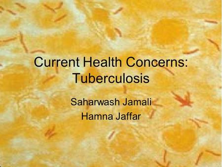 Current Health Concerns: Tuberculosis Saharwash Jamali Hamna Jaffar.