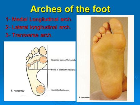 Arches of the foot 1- Medial Longitudinal arch.