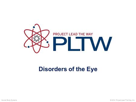 Disorders of the Eye © 2014 Project Lead The Way, Inc.Human Body Systems.