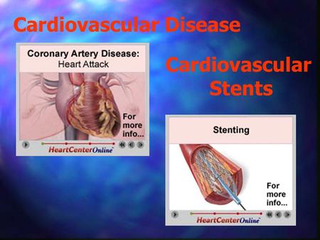 Cardiovascular Disease Cardiovascular Stents. Cardiovascular Stents Presented by:  Introduction - Becky Rentz  The Problem – Kim Noah  Significance.