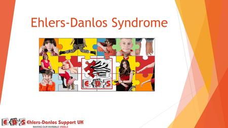 Ehlers-Danlos Syndrome. Ehlers-Danlos Syndromes  A group of separate conditions  You cannot pass on a type you don’t have  Currently 7 types recognised.