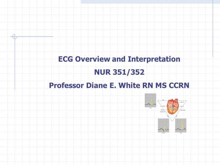 ECG Overview and Interpretation NUR 351/352 Professor Diane E. White RN MS CCRN.