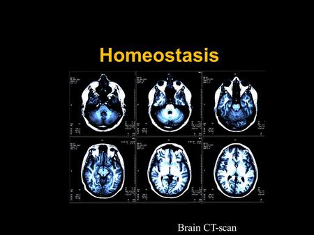 Homeostasis Brain CT-scan Importance of Homeostasis in Mammals  metabolic reactions are controlled by enzymes  enzymes work best in a narrow range.