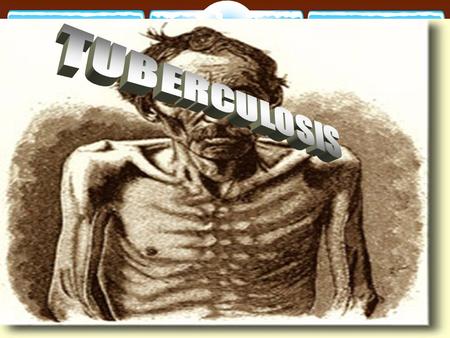 Pulmonary TB. BY PROF.  AZZA ELMedany OBJECTIVES  At the end of lecture, the students should:  Discuss the etiology of tuberculosis  Discuss the.