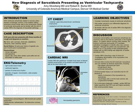 LEARNING OBJECTIVES Consider nonischemic causes of ventricular arrhythmia Add cardiac sarcoid to your differential diagnosis for ventricular arrhythmia.
