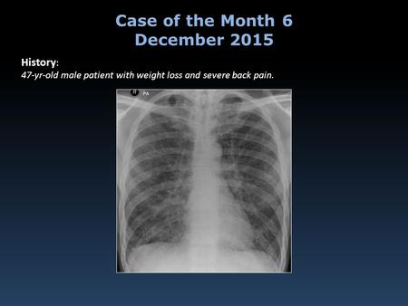 Case of the Month 6 December 2015