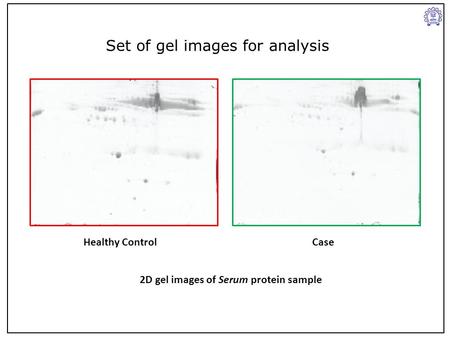Healthy ControlCase 2D gel images of Serum protein sample Set of gel images for analysis.