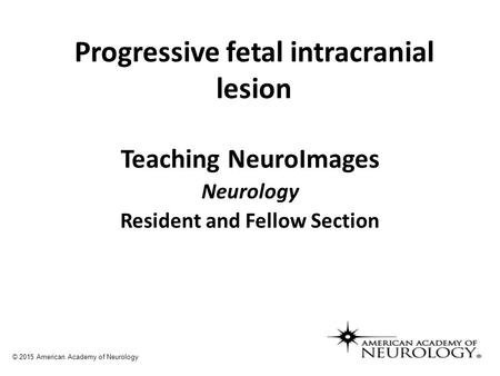 Progressive fetal intracranial lesion Teaching NeuroImages Neurology Resident and Fellow Section © 2015 American Academy of Neurology.