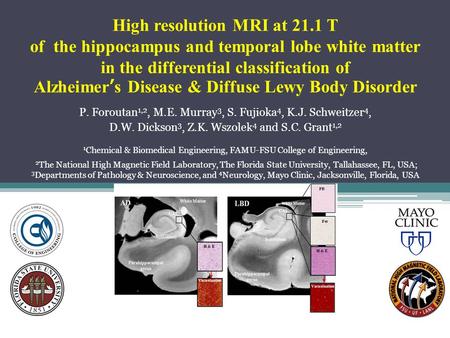 High resolution MRI at 21.1 T of the hippocampus and temporal lobe white matter in the differential classification of Alzheimer’s Disease & Diffuse Lewy.