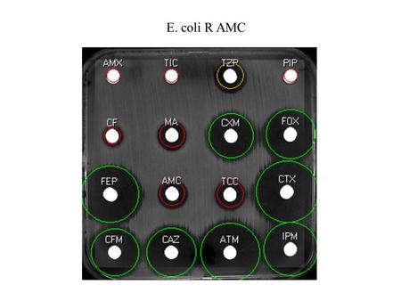 E. coli R AMC. E. coli R AMC 2 E. coli AMC R E. coli AMC R.