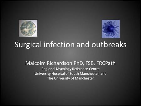 Surgical infection and outbreaks Malcolm Richardson PhD, FSB, FRCPath Regional Mycology Reference Centre University Hospital of South Manchester, and The.