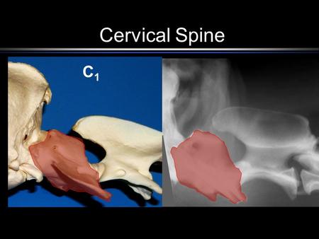 Cervical Spine C1C1. C2C2 Structures of C 1 Lateral Vertebral Foramen.