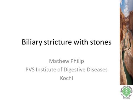 Biliary stricture with stones