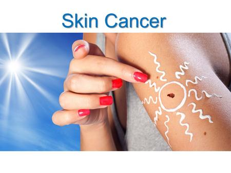Skin Cancer. Skin Cancer: Warm-Up #3 Complete the “Are you at Risk” WS.
