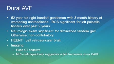 Dural AVF 52 year old right-handed gentleman with 3 month history of worsening unsteadiness. ROS significant for left pulsatile tinnitus over past 2 years.
