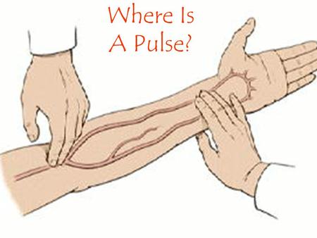 Where Is A Pulse?.