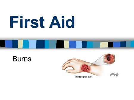 First Aid Burns. Burns Classified as either Thermal (Heat) Chemical Electrical.
