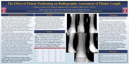 The Effect of Patient Positioning on Radiographic Assessment of Fibular Length. Corine L. Creech, DPM a, Laura E. Sansosti, DPM a, and Andrew J. Meyr,