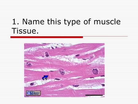 1. Name this type of muscle Tissue.. 2. Which of the four types of tissue is this slide?