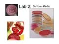 Lab 2: Culture Media. In this lab we learn about different types of media that are used to grow bacteria. Some types of media will grow just about any.