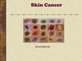 Skin Cancer Sylvie Sabones. Skin Cancer Most common cancer in US Fastest increasing cancer in US 1,000,000 people had some form of skin cancer in 2003.