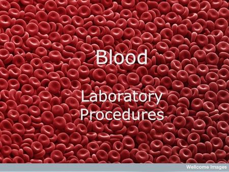 Hematology Defined: The study of blood Why is hematology important? Evaluation of disease states Screening for well animals as a baseline Pre-anesthetic.