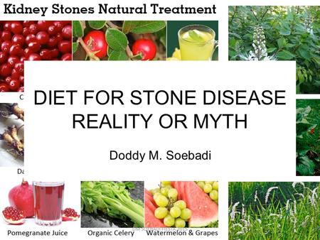DIET FOR STONE DISEASE REALITY OR MYTH Doddy M. Soebadi DM SOEBADI FIESTA 20151.