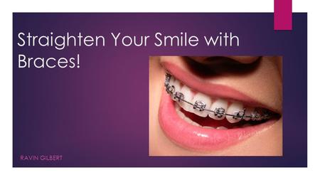 Straighten Your Smile with Braces! RAVIN GILBERT.