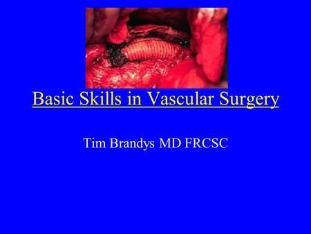 Basic Skills in Vascular Surgery Tim Brandys MD FRCSC.