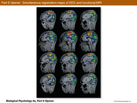 Part 6 Opener Simultaneous registration maps of EEG and functional MRI.