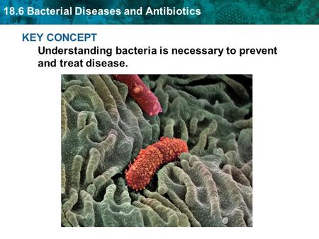 18.6 Bacterial Diseases and Antibiotics KEY CONCEPT Understanding bacteria is necessary to prevent and treat disease.