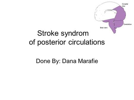 Stroke syndromes of posterior circulations