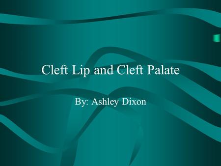 Cleft Lip and Cleft Palate By: Ashley Dixon. Causes During the early stages of pregnancy, the upper lip and palate develop from tissues lying on either.
