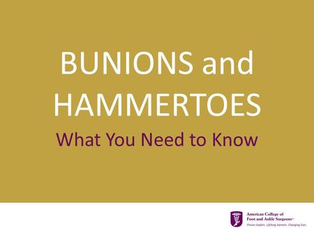 BUNIONS and HAMMERTOES What You Need to Know.  Bunions and hammertoes are very common  Many people have both Did you know…