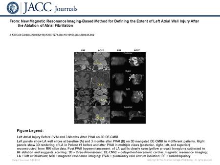 Date of download: 5/28/2016 Copyright © The American College of Cardiology. All rights reserved. From: New Magnetic Resonance Imaging-Based Method for.