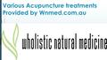 Various Acupuncture treatments Provided by Wnmed.com.au.