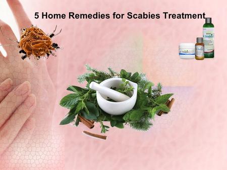 5 Home Remedies for Scabies Treatment. What is Scabies ? Scabies is a very uncomfortable, contagious skin condition commonly seen in children and young.
