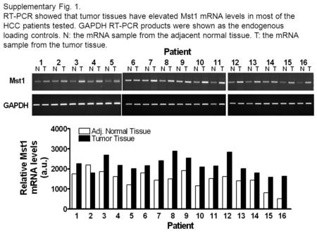 Supplementary Fig. 1. RT-PCR showed that tumor tissues have elevated Mst1 mRNA levels in most of the HCC patients tested. GAPDH RT-PCR products were shown.