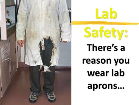 Lab Safety: There’s a reason you wear lab aprons….