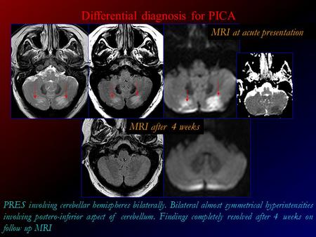 Differential diagnosis for PICA