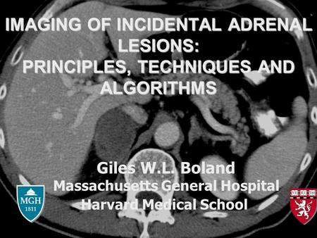 IMAGING OF INCIDENTAL ADRENAL LESIONS: PRINCIPLES, TECHNIQUES AND ALGORITHMS Giles W.L. Boland Massachusetts General Hospital Harvard Medical School.